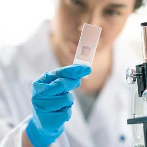 肺炎患者痰培养检出念珠菌有意义吗？是否需要报告，如何报告？ ...